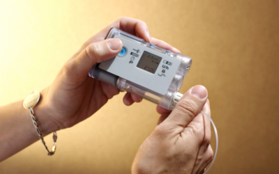 New Study Shows Blood Sugar Levels Affect Risks in Type 1 Diabetes